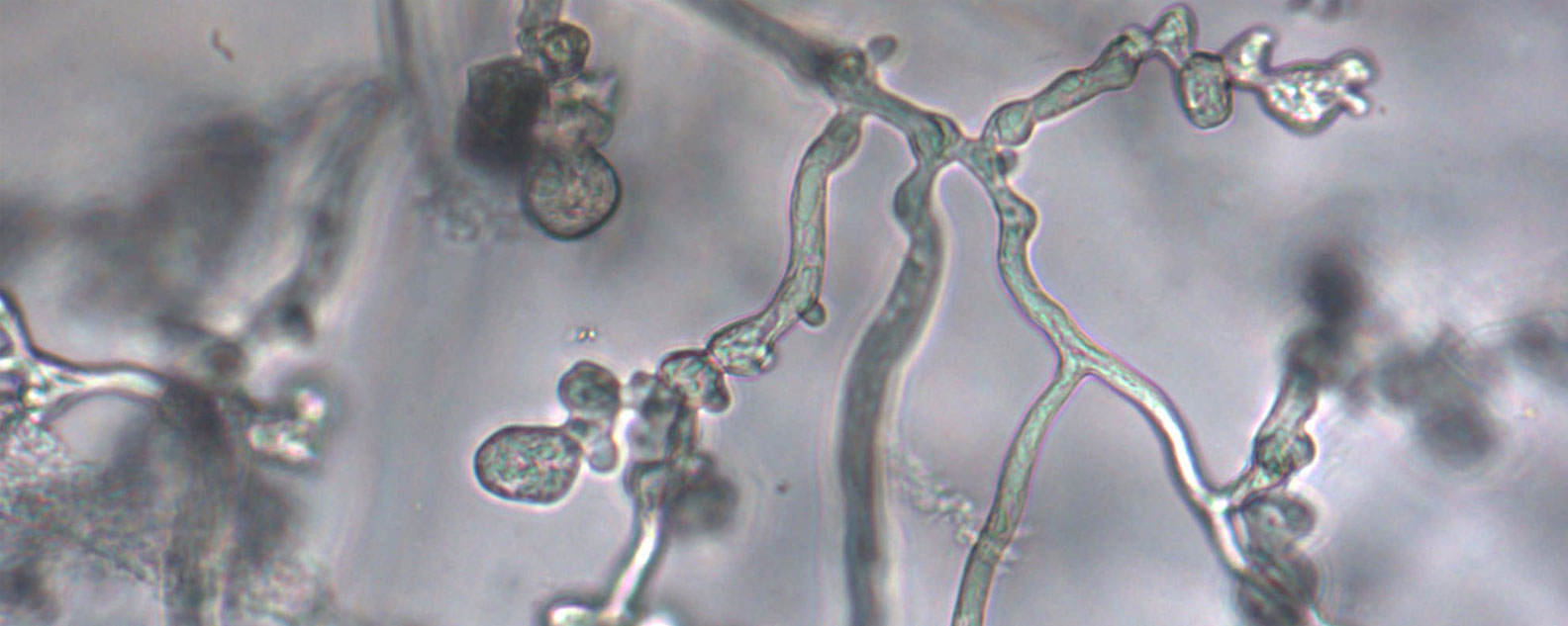 Phytophthora cinnamomi fungal hyphae under the microscope