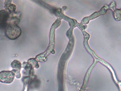 A picture through a microscope of Phytophthora cinnamomi fungal hyphae
