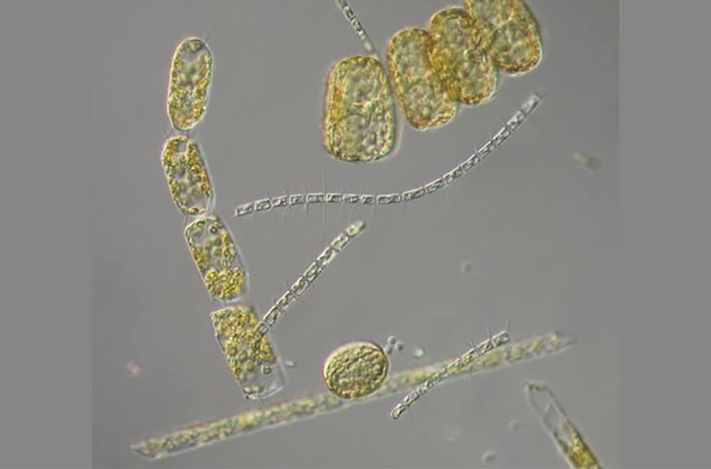 A microscopic view of diatoms