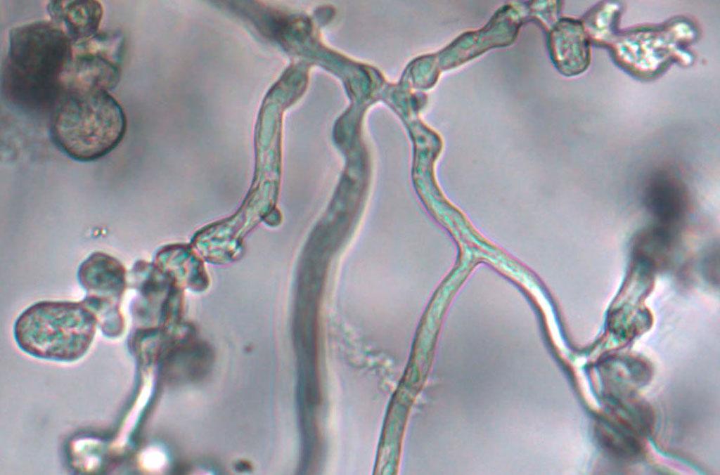 Phytophthora cinnamomi fungal hyphae under a microscope